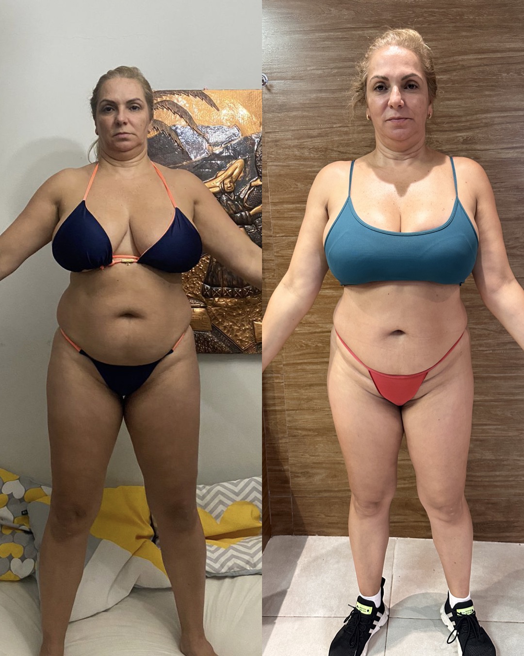Antes e depois de aluna da Ana Alves